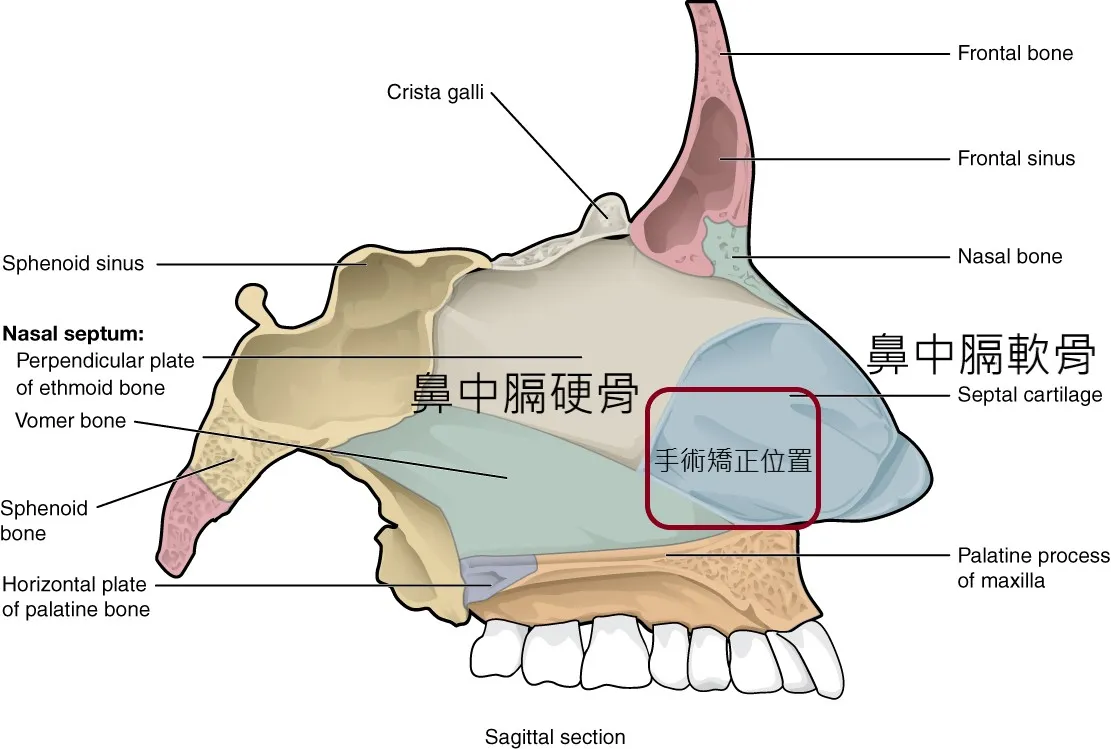 鼻中隔手術解剖位置示意圖 — 微創鼻中隔成形手術